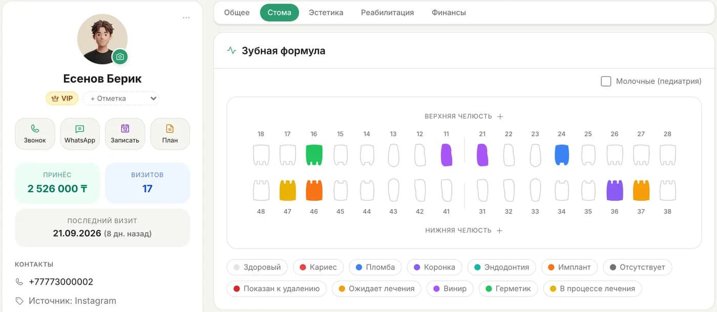 Зубная формула пациента в Kanri: верхняя и нижняя челюсть, отметки по зубам